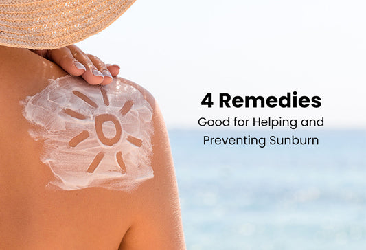 4 Remedies Good for Helping and Preventing Sunburn