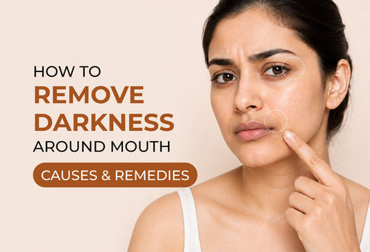 Darkness Around Mouth