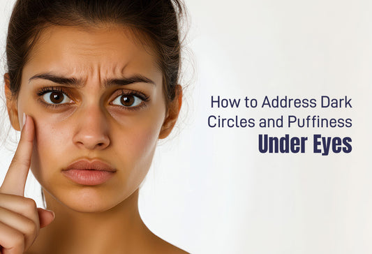 How to Address Dark Circles and Puffiness Under Eyes