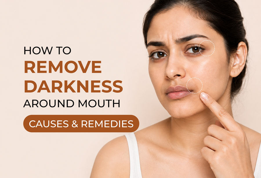 Darkness Around Mouth