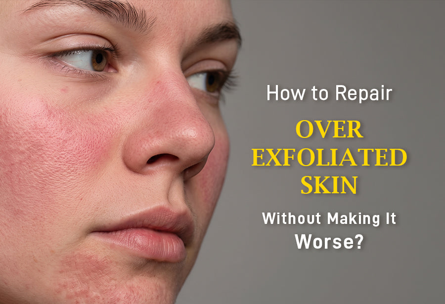 Over Exfoliated Skin