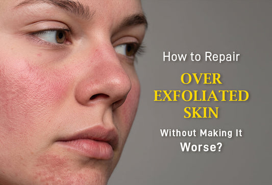 Over Exfoliated Skin