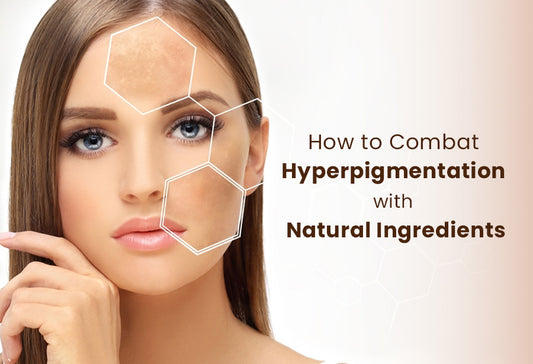 How to Combat Hyperpigmentation with Natural Ingredients