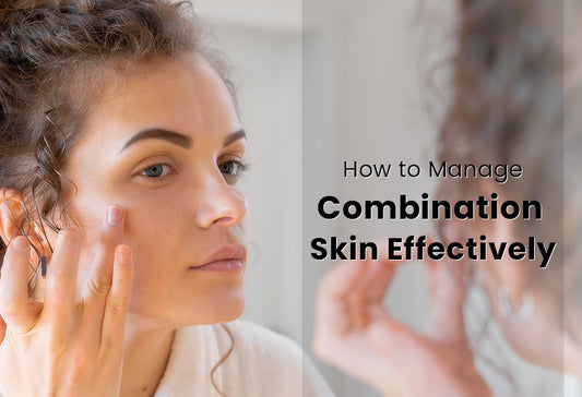 How to Manage Combination Skin Effectively